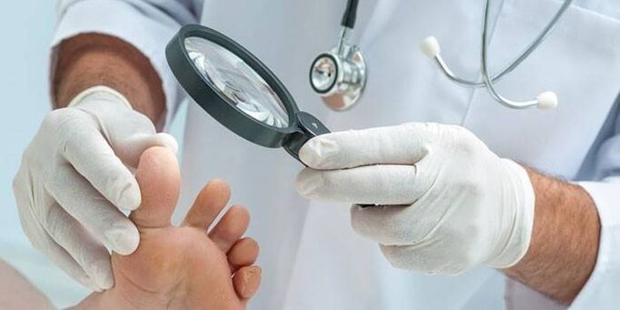 Zdravnik s povečevalnim steklom pregleda stopalo bolnika s konico