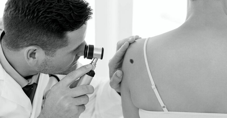 specialist diagnosticira vrsto bradavice